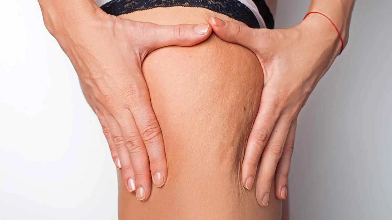Gambe gonfie e doloranti? Mangia subito questi cibi per sfiammarle